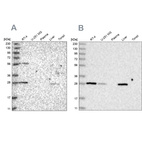 Western blot analysis using Anti-BPHL antibody HPA036753 (A) shows similar pattern to independent antibody HPA036752 (B).