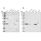 Western blot analysis using Anti-BPHL antibody HPA036753 (A) shows similar pattern to independent antibody HPA036752 (B).