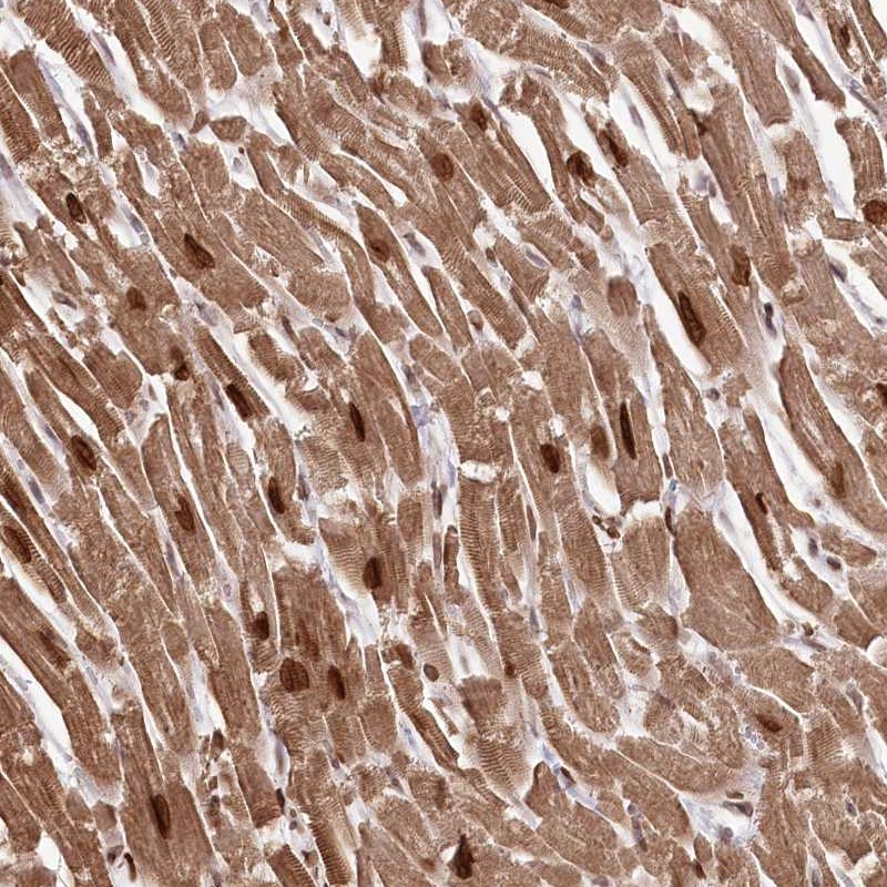 Anti-SORBS2 Antibody