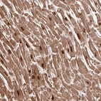 Anti-SORBS2 Antibody