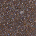 Anti-P2RY10 Antibody