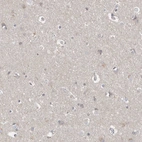 Immunohistochemical staining of human cerebral cortex shows no positivity in neurons as expected.