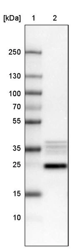 Lane 1: Marker [kDa]_br/_Lane 2: Human cell line U-251 MG