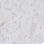 Immunohistochemical staining of human skeletal muscle shows no positivity in myocytes as expected.