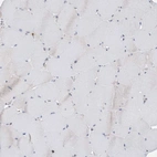 Immunohistochemical staining of human skeletal muscle shows no positivity in myocytes as expected.