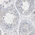 Immunohistochemical staining of human testis shows no positivity in cells in seminiferous ducts as expected.