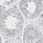 Immunohistochemical staining of human testis shows no positivity in cells in seminiferous ducts as expected.