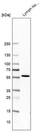 Western blot analysis in human lymph node tissue.
