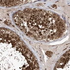 Immunohistochemical staining of human testis shows strong cytoplasmic and nuclear positivity in cells in seminiferous ducts.