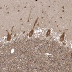 Immunohistochemical staining of human cerebellum shows moderate cytoplasmic positivity in Purkinje cells.