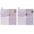 Immunohistochemical staining of human colon, pancreas, skeletal muscle and small intestine using Anti-GCG antibody HPA036760 (A) shows similar protein distribution across tissues to independent antibody HPA036761 (B).