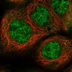 Immunofluorescent staining of human cell line A-431 shows localization to nuclear speckles.