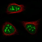 Immunofluorescence staining of U-2 OS cells using the Anti-MK167 monoclonal antibody, showing specific staining in the nucleoli in green. Microtubule- and nuclear probes are visualized in red and blue, respectively (where available).