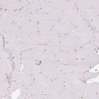 Immunohistochemical staining of human skeletal muscle shows no positivity in myocytes as expected.