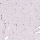 Immunohistochemical staining of human skeletal muscle shows no positivity in myocytes as expected.