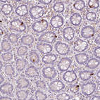 Immunohistochemical staining of human small intestine shows strong cytoplasmic positivity in enteroendocrine cells.