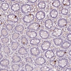Immunohistochemical staining of human small intestine shows strong cytoplasmic positivity in enteroendocrine cells.