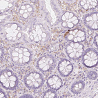 Immunohistochemical staining of human colon shows moderate cytoplasmic positivity in enteroendocrine cells.