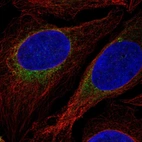 Immunofluorescent staining of human cell line U-2 OS shows localization to endoplasmic reticulum.
