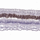Immunohistochemical staining of human retina shows moderate nuclear positivity in outer nuclear layer (rod and cone cell bodies).
