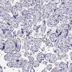 Immunohistochemical staining of human placenta shows no positivity in trophoblastic cells as expected.