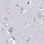 Immunohistochemical staining of human cerebral cortex using Anti-CRX antibody HPA036762.