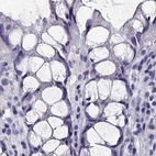 Immunohistochemical staining of human colon using Anti-CRX antibody HPA036762.