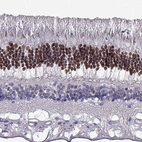 Immunohistochemical staining of human eye, retina using Anti-CRX antibody HPA036762.