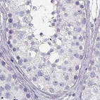 Immunohistochemical staining of human testis using Anti-CRX antibody HPA036762.