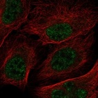 Anti-RNPEPL1 Antibody