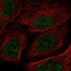 Anti-RNPEPL1 Antibody