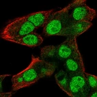 Immunofluorescent staining of human cell line Hep G2 shows localization to nucleoplasm.