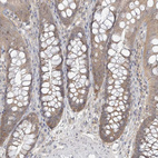 Immunohistochemical staining of human colon shows weak cytoplasmic positivity in glandular cells.