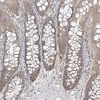 Immunohistochemical staining of human colon shows weak cytoplasmic positivity in glandular cells.