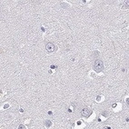 Immunohistochemical staining of human cerebral cortex using Anti-CRX antibody HPA036763.