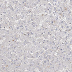 Immunohistochemical staining of human liver shows no positivity in hepatocytes as expected.