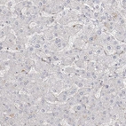 Immunohistochemical staining of human liver shows no positivity in hepatocytes as expected.