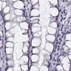 Immunohistochemical staining of human colon using Anti-CRX antibody HPA036763.