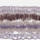 Immunohistochemical staining of human eye, retina using Anti-CRX antibody HPA036763.