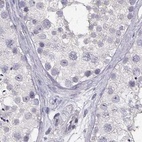 Immunohistochemical staining of human testis using Anti-CRX antibody HPA036763.