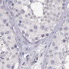 Immunohistochemical staining of human testis using Anti-CRX antibody HPA036763.