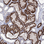 Anti-C5orf42 Antibody
