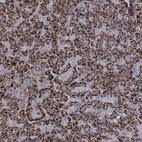 Immunohistochemical staining of human pancreas shows strong granular cytoplasmic positivity in exocrine glandular cells.