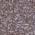 Immunohistochemical staining of human pancreas shows strong granular cytoplasmic positivity in exocrine glandular cells.
