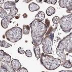 Immunohistochemical staining of human placenta shows moderate granular cytoplasmic positivity in trophoblastic cells.