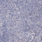 Immunohistochemical staining of human tonsil shows no positivity in non-germinal center cells as expected.