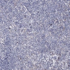 Immunohistochemical staining of human tonsil shows no positivity in non-germinal center cells as expected.
