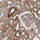 Immunohistochemical staining of human Kidney shows strong membranous and cytoplasmic positivity in cells in tubules and glomeruli.