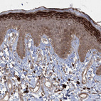 Immunohistochemical staining of human Skin shows strong cytoplasmic positivity in epidermal cells.