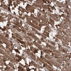 Immunohistochemical staining of human Heart muscle shows strong cytoplasmic positivity in cardiomyocytes.